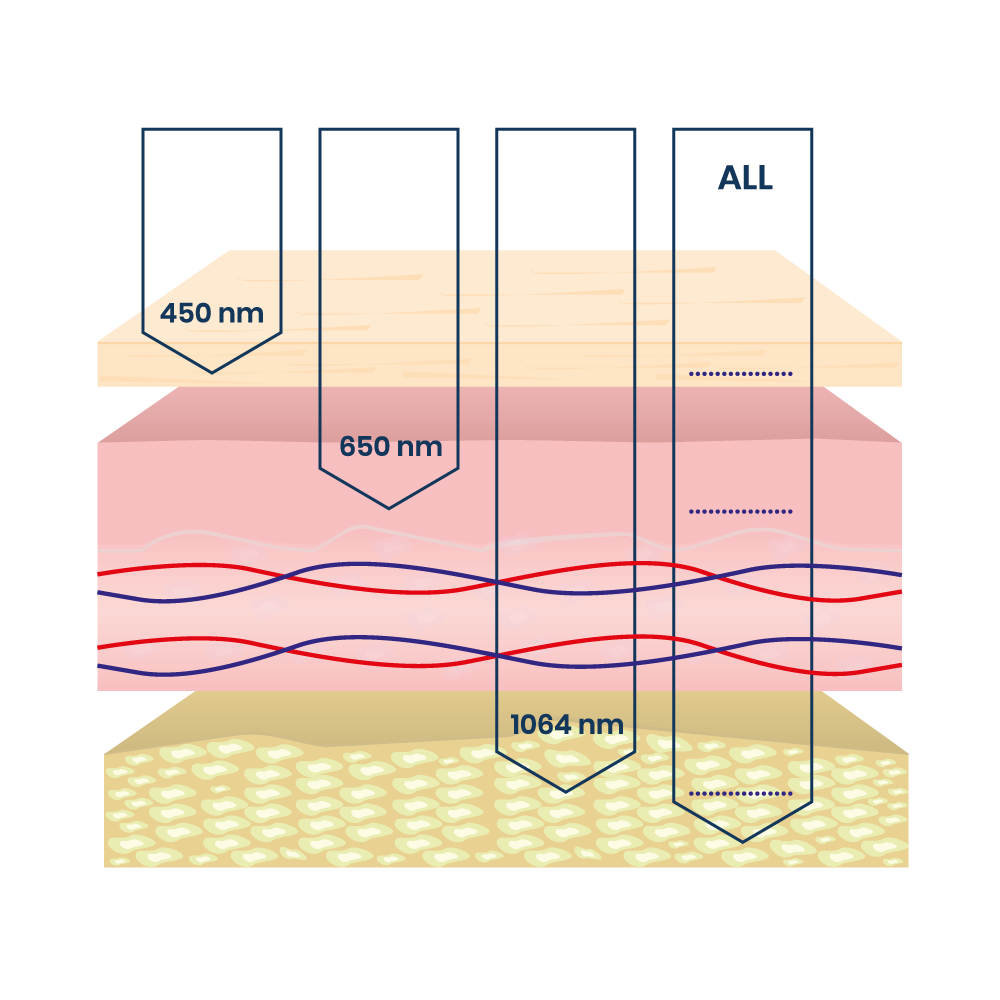 Low Level Laser Therapy